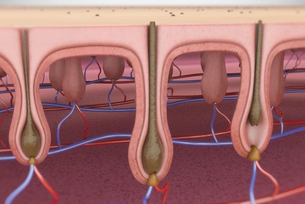 Depilacja Laserowa Animacja 3D