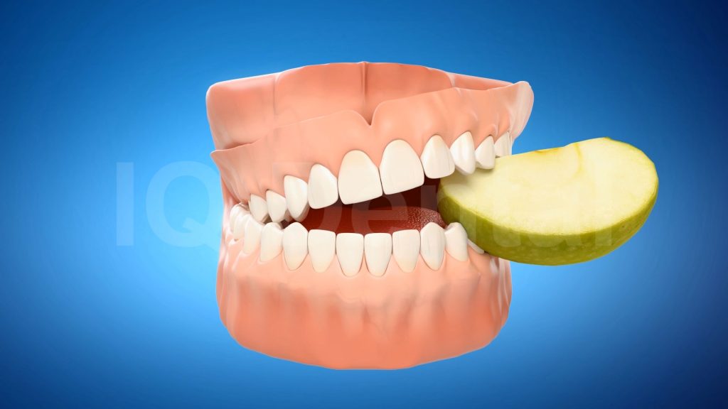 3vo Dentystyczne Animacje 3D 005 3vo Dentystyczne Animacje 3D
