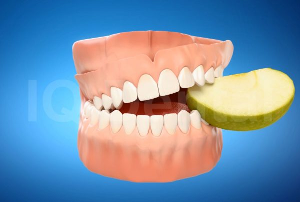 3vo Dentystyczne Animacje 3D